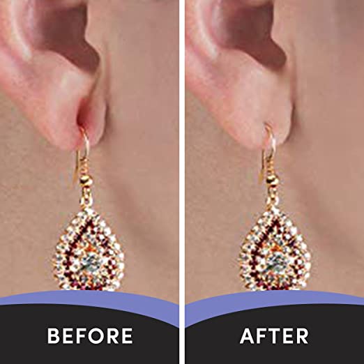 Miracle Stretched earlobe Corrector shrinking oil fix torn and stretched  piercing hole no more ear lobe support patches for earrings Miracle Ear  Lobe 
