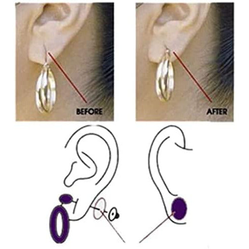 Miracle Stretched earlobe Corrector shrinking oil fix torn and stretched  piercing hole no more ear lobe support patches for earrings Miracle Ear Lobe  