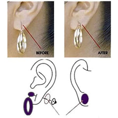 LOBE MIRACLE - Earring Support Patches (60 Patches/Pack)